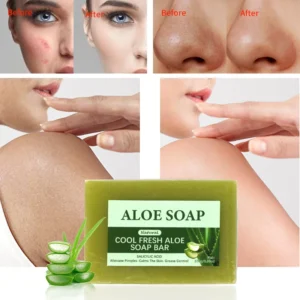 Vegan Aloe Vera Soap: Removes Acne and Blemishes, Brightens the Skin, Enhances Skin Glow, Suitable for All Skin Types